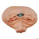 Morris CYCLOPS PROSTHETIC