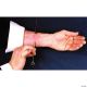 Morris NEEDLE THRU ARM