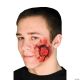 Morris OPEN WOUND PROSTHETIC