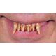 Morris WITCH TEETH